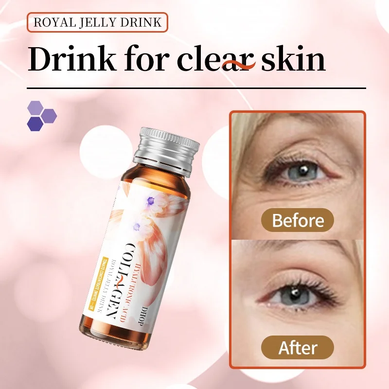 OEM royal jelly collagen and hyaluronic acid drink Marine super collagen drink for Whitening skin Anti-aging
