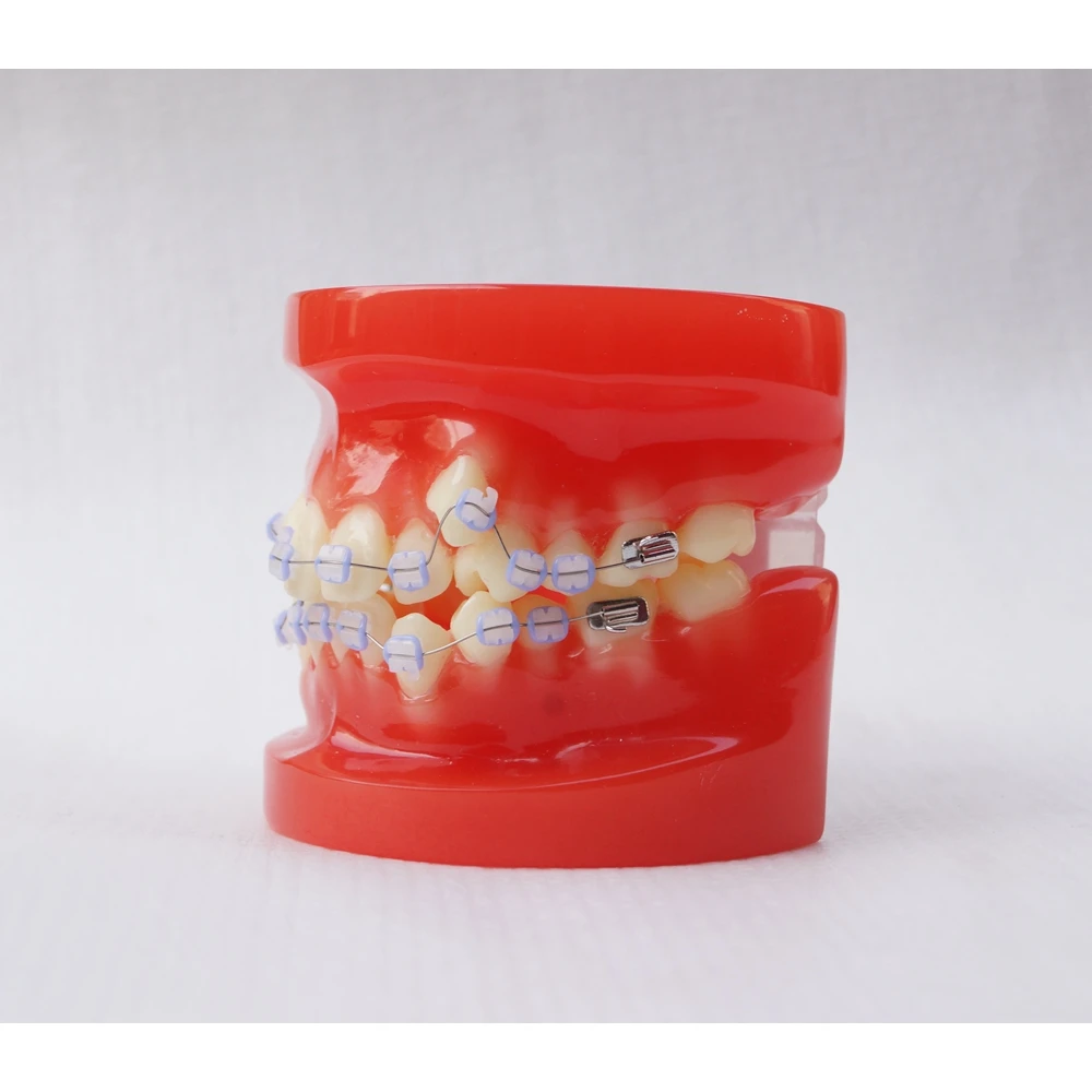 Dental Typodont Model Study Teeth Model With Ceramic Bracket