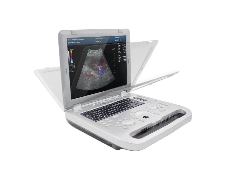 CONTEC CMS1700A colour doppler ultrasound scanner 3in 1 wifi  portable ultrasound table