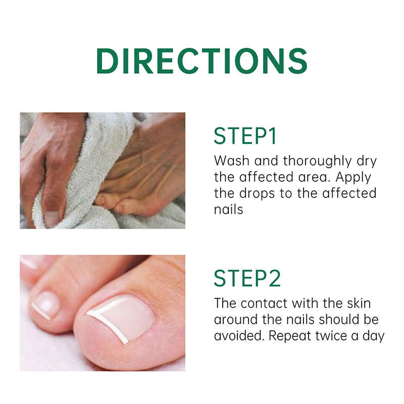 Private Label Nail Treatment Oil Anti Infection Paronychia Onychomycosis Feet Care Nail Fungus Removal Gel Care