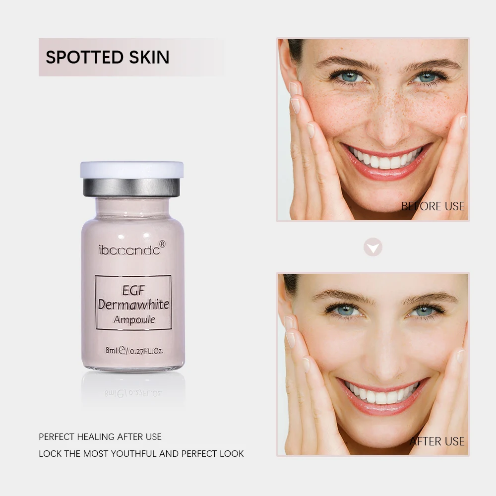 Wholesale Meso Serum Skin Whitening Stem Cell Culture Ampoule BB facial Foundation glow cream with Roller