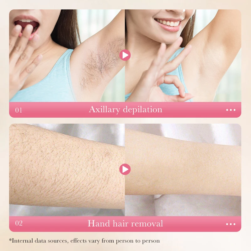 SADOER Private Label Organic Full Body Painless Sensitive Skin Hair Removal Foam Mousse Instant Whitening Hair Remover Cream