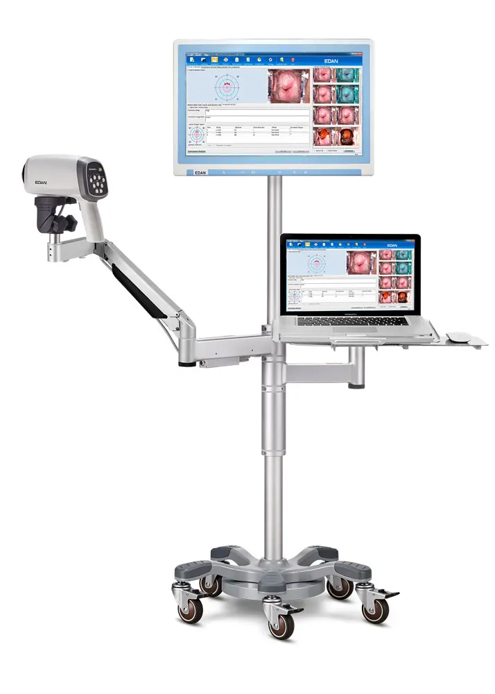  Оригинальное HD видео Colposcope EDAN C3A C6A цифровое colposcopio edan colposcope
