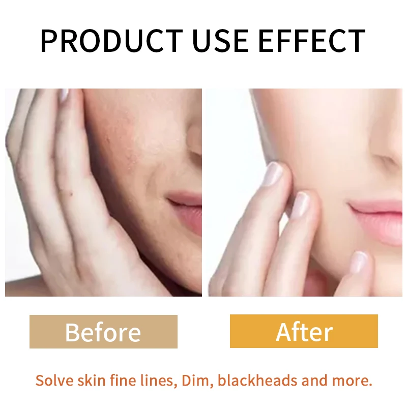 50sets Custom Skincare Set Private Label Tumeric Vitamin C Skin Care Kit Hydrating Repairing Lightening Turmeric Skin Care Set