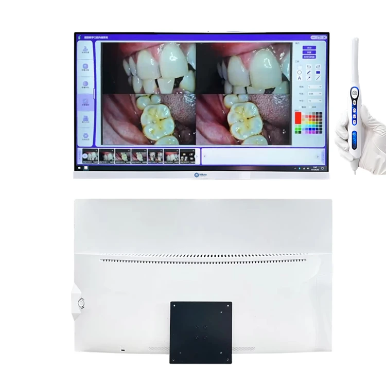 Dental Equipments touch screen type computer Integrated Window10 System 24-inch dental Endoscope Intraoral Camera with Bracket