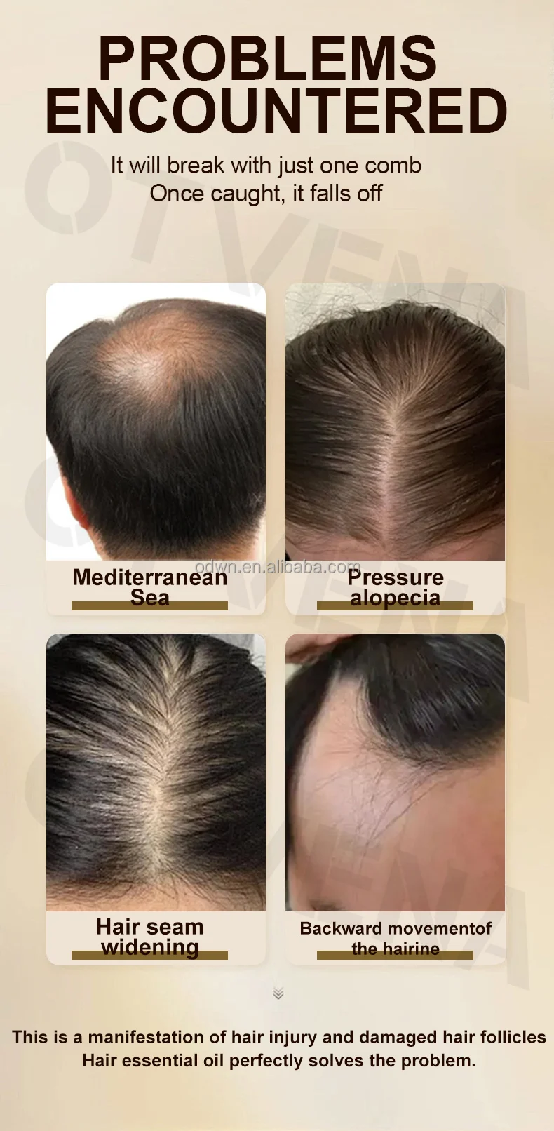 Contract Manufacturing Hair Care Organic Growth Hair Oil Anti Hair Loss Scalp Serum For Men Women