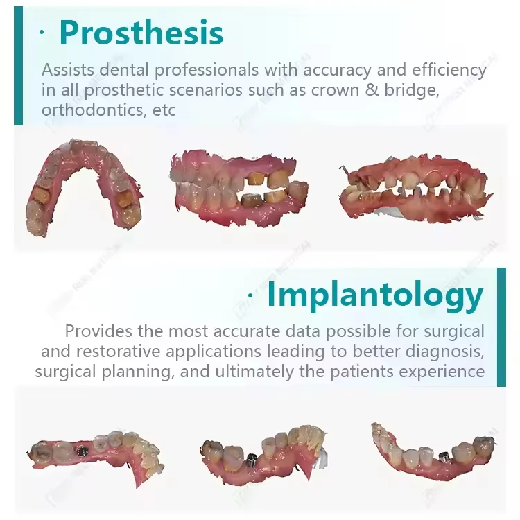 Cheap High Accuracy Manufacturer Price 3D Intraoral Scanner LED Ce Dental Cad Cam Price Oral Therapy Equipments & Accessories 2m