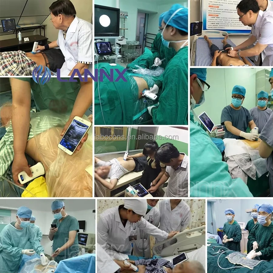 LANNX uRason CW6+ New 128 elements 3 in 1 USG Wireless Ultrasound Probe Thyroid Pregnancy Cardiac Color Doppler Probe Ultrasound