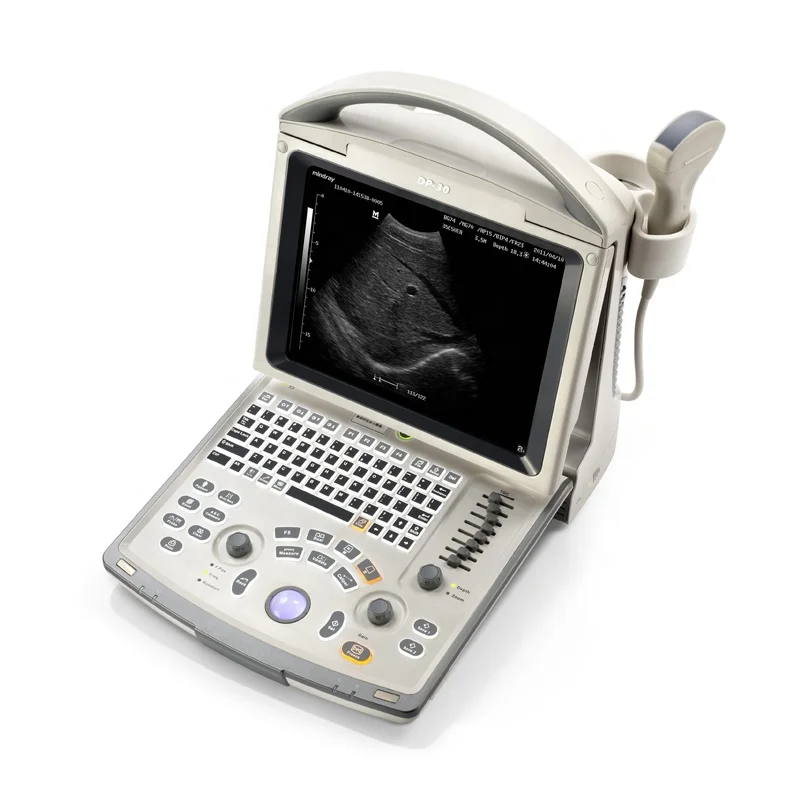 Mindray ultrasound machine digital ultrasonic ultrasound scanner mindray dp 30 ultrasound machine china