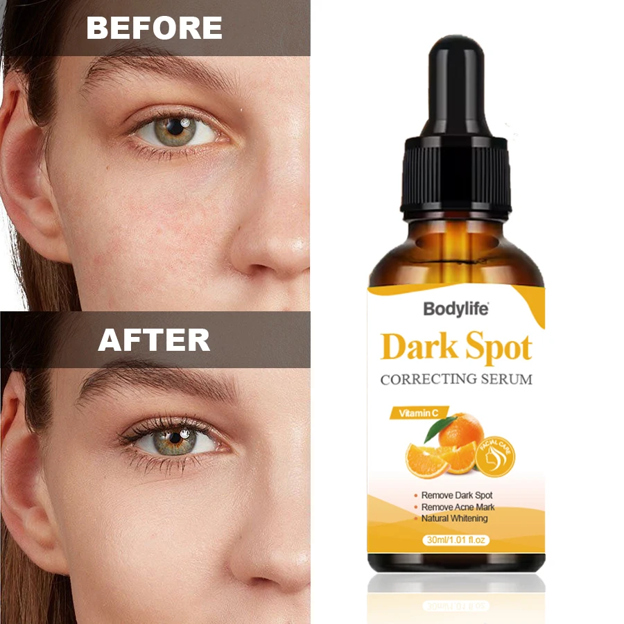 OEM Herbal Freckle Lightening Skin Care Korean Vitamin C Dark Spot Removal Corrector Serum For Face Treatment
