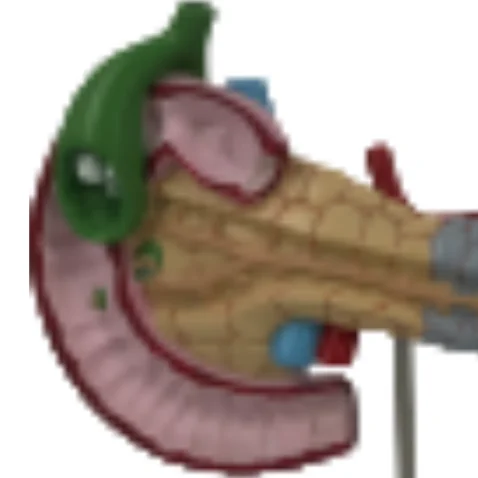 ADA  Pancreas, duodenum spleen models and Pancreatic bile duct pathological model with Pancreatic bile duct pathological model
