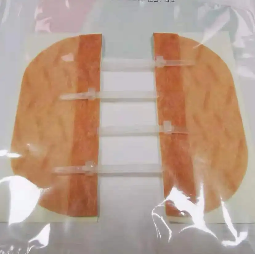 Quick apply surgical incision zip wound skin closure sterile strip skin closure