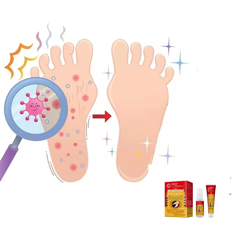 foot care products medicine gentle formula antifungal spray hand ringworm beriberi fungus spray