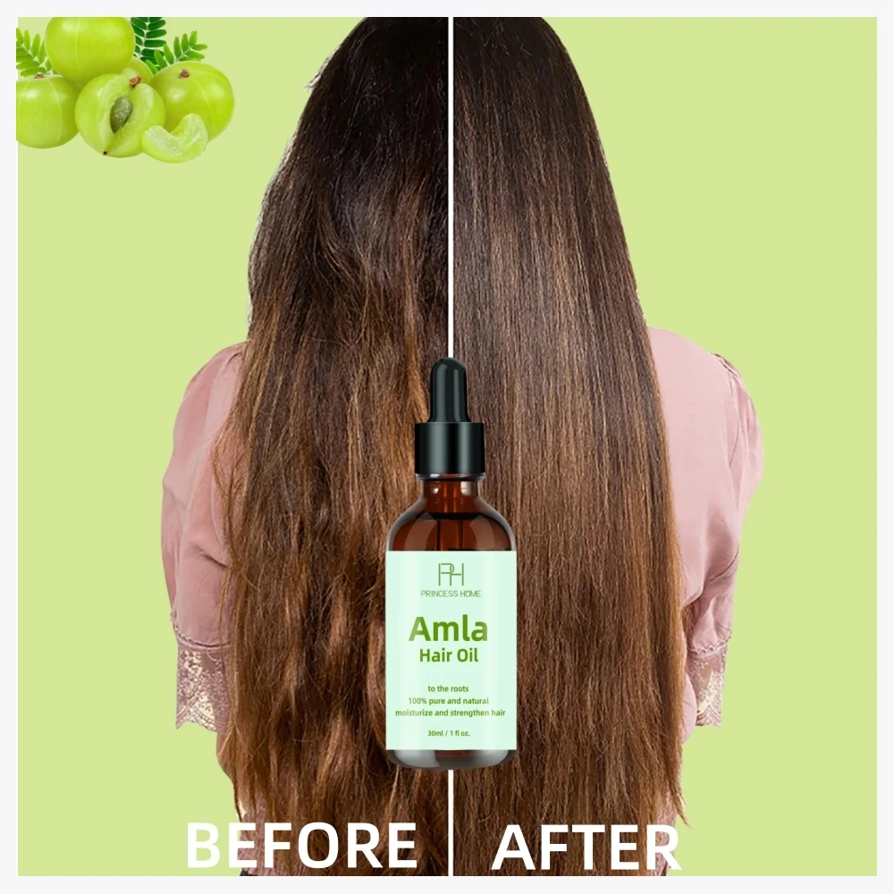 30ml Custom Logo Prevents Hair Breakage Hair Growth Moisturizing Natural and Cold Pressed Organic Amla Hair Essential Oil