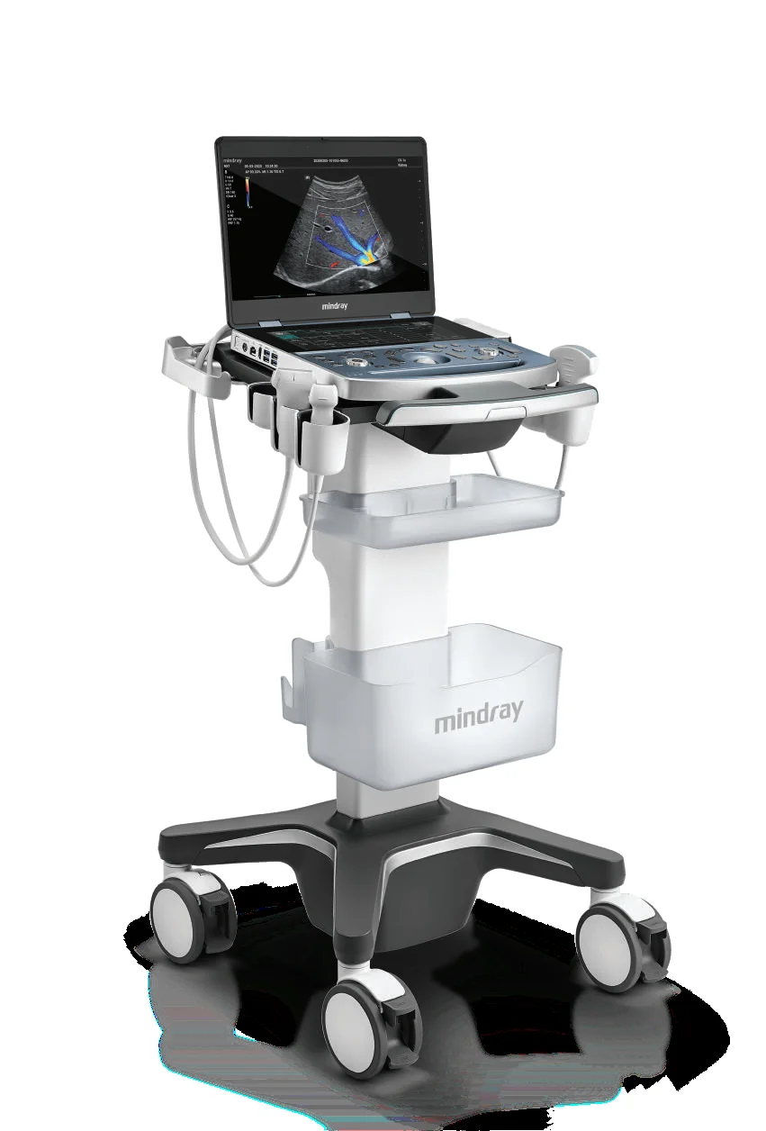 Mindray  MX7 Color Doppler Ultrasound