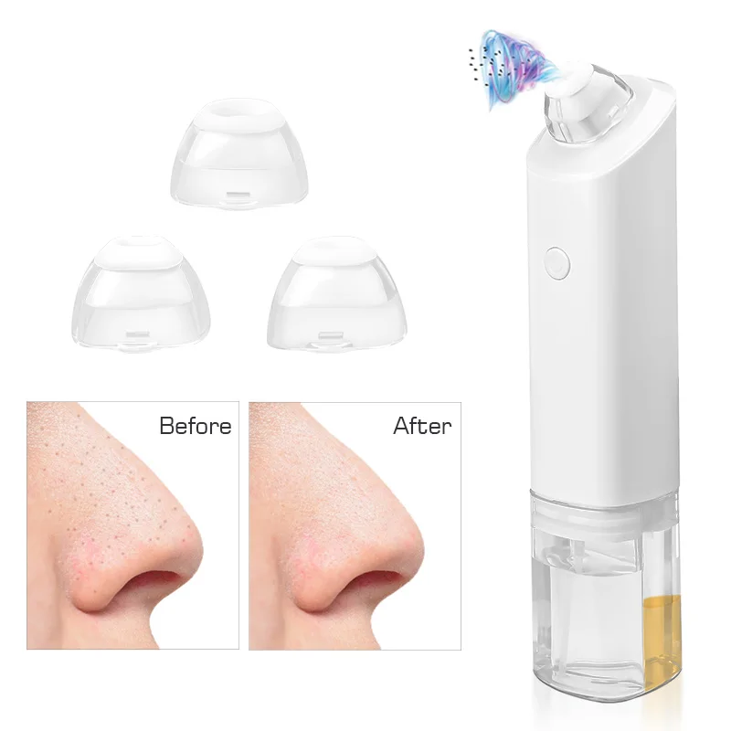 3 Silicone Vacuum Suction Electric Facial Nose Pore Vacuum Water Cycle Small Bubble Blackhead Remover