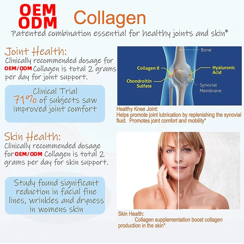 Glucosamine Chondroitin Msm Joint Support Supplement Bone Health For Joint Relief Bone Strength 90 Tablets