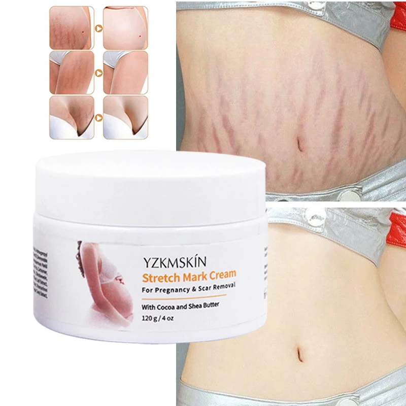 OEM Wholesale Private Label Stretch Mark Cream to Protect Tummy Hips and Thighs pregnancy marks Maternity Stretch Mark cream