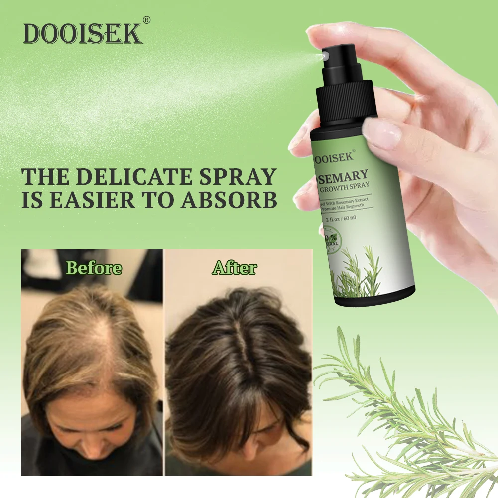 New Factory Fast Speed Organic Miele Rosemary Oil Hair Growth For Baby Natural Hair Growth Essential Oil Hair Growth Products