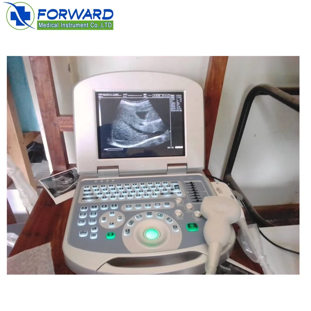 Medical Echography Portable Ultrasound Machine 3D 4D