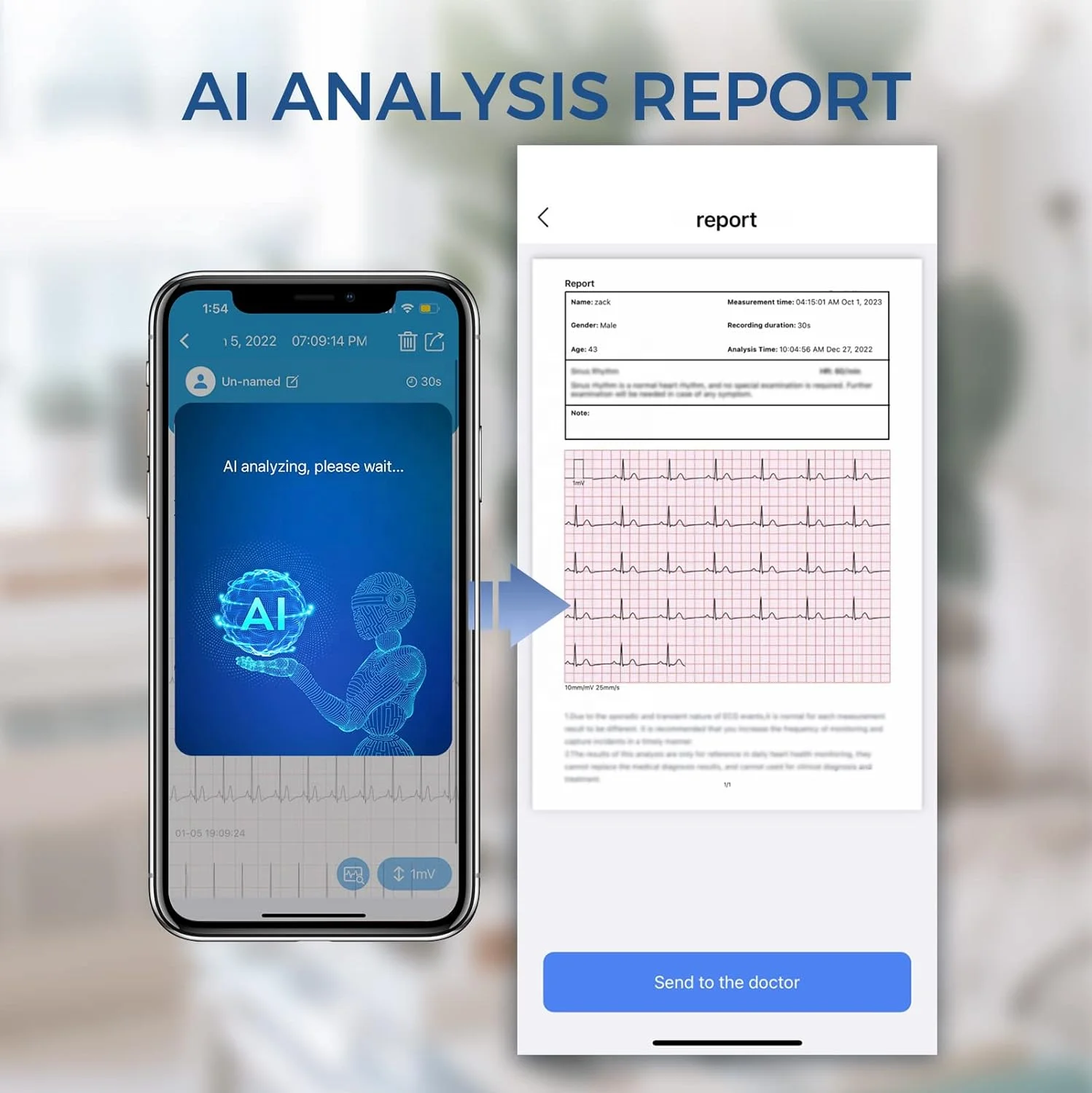 Wellue BP2 WiFi Bp Machine Automatic Digital Ecg Monitor Digital Upper Arm Blood Pressure Monitor