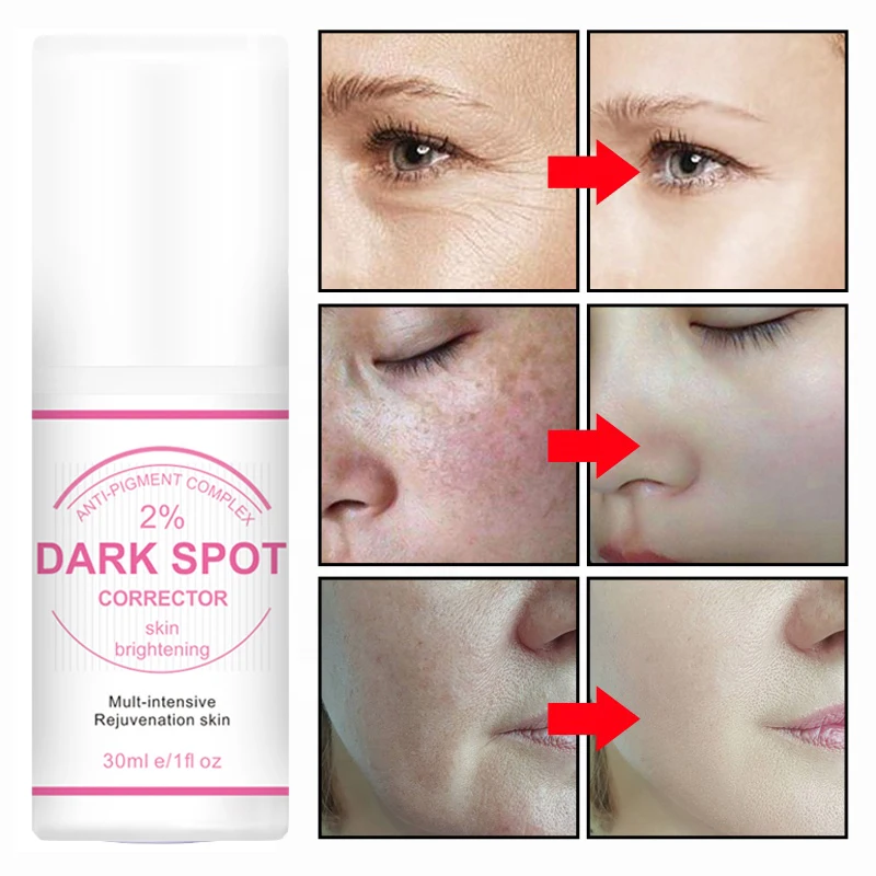 private label Best Korean Whitening Crean Niacinamide Fast Lightening Body Underarm Permanent Skin Whitening Dark Spot Corrector