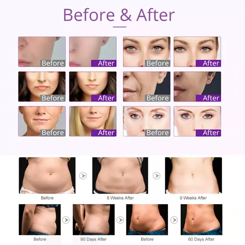 2024 Portable Rf Radio Frequency V Shape Machine RF Slimming Machine for Home Use Fat Body Contouring Sculpting 3 in 1 4 Pcs