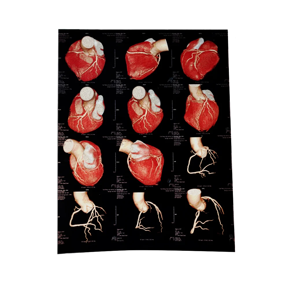 
Cheap medical radiological x ray film cassette 