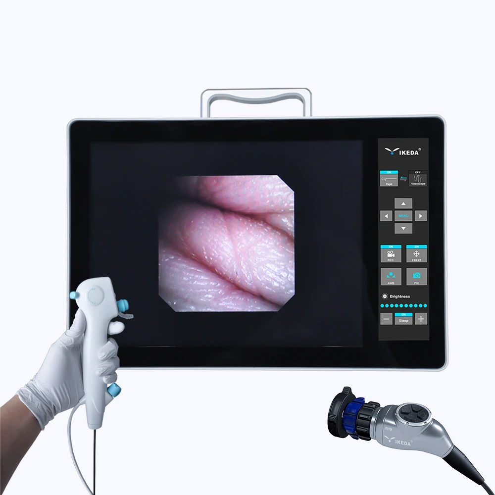 AKX DUAL-USE Veterinary Rigid Disposable Video Portable USB Veterinary ENT Endoscope Camera AKX-9685H