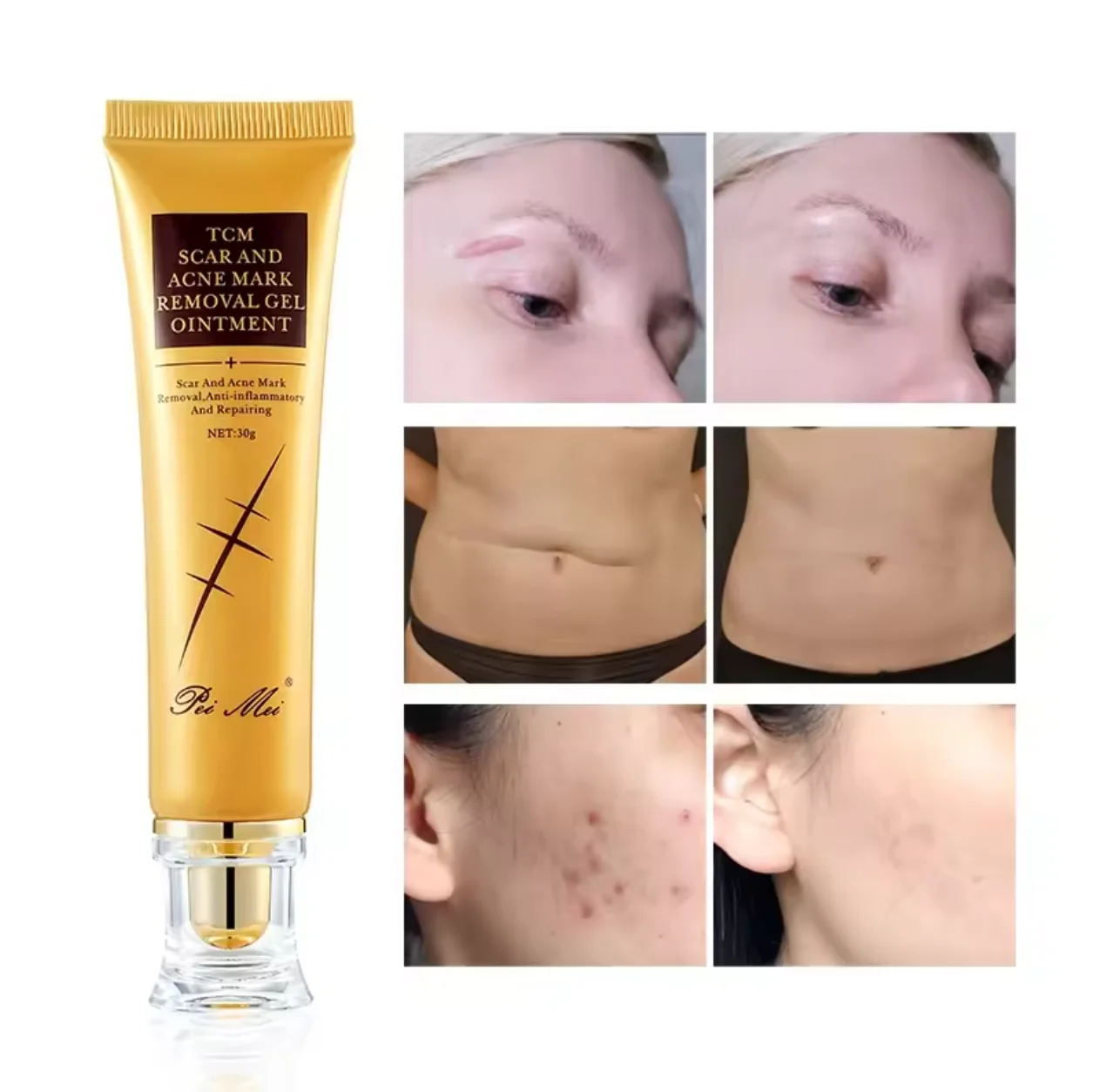 Wholesale custom face cream black spot acne whitening for face and legs old scar removing scar freckle face cream