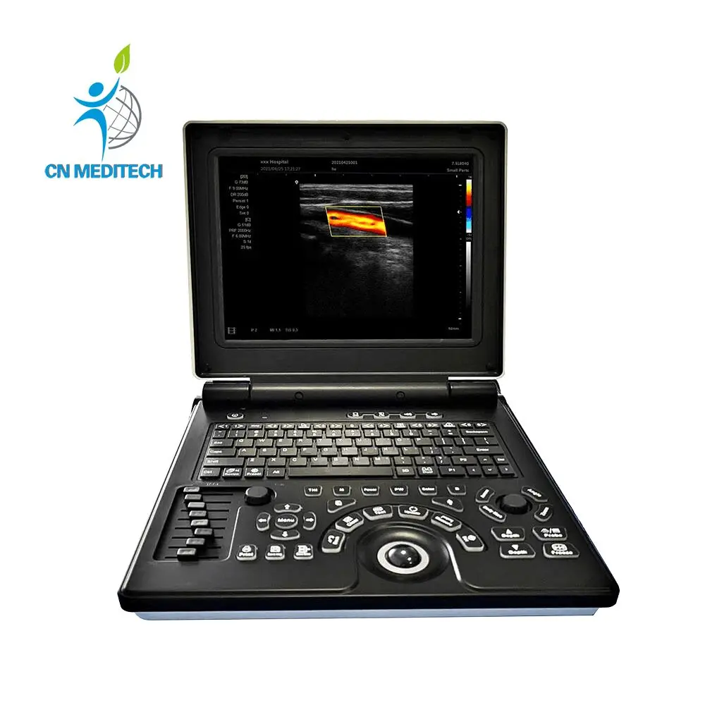Medical Professional Cardiology Hospital 3D Color Doppler Ultrasound