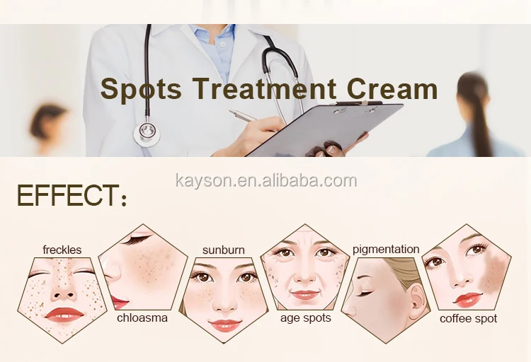 Herbal Extract Anti Spot Whitening Night Freckle Removing Cream for Face Made in Japan