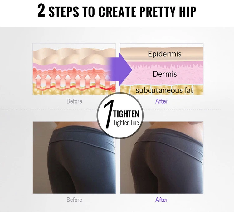 Big Butt Buttocks Enlargemen