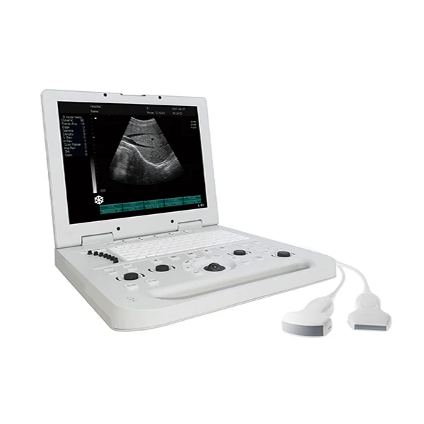 High Quality portable digital B/W Ultrasound Machine for clinic