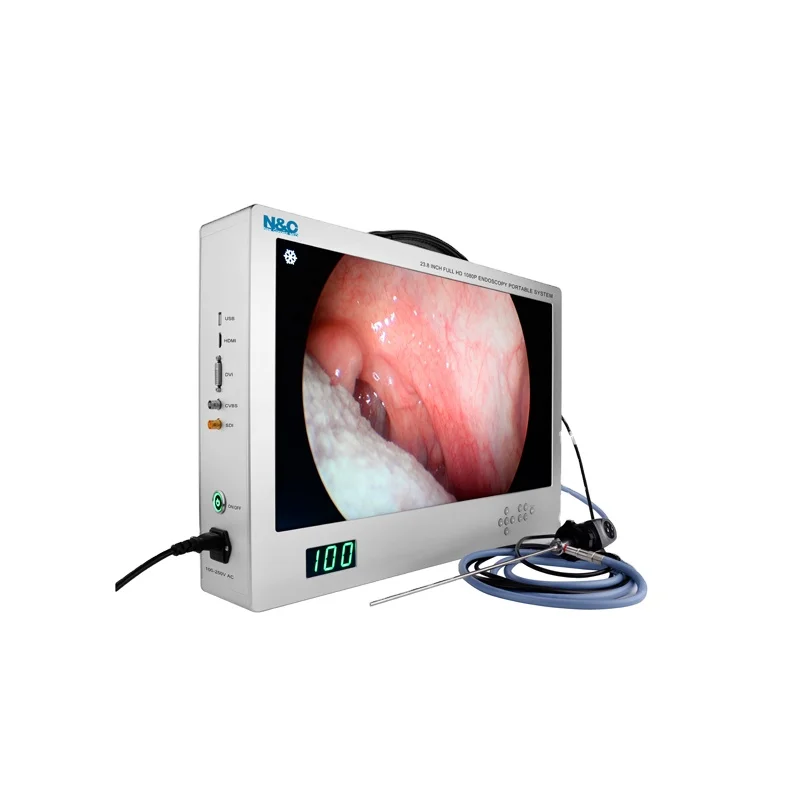 Все в одном Full HD OEM медицинская эндоскопическая камера с 24 дюймовый монитор и 80 Вт источник света