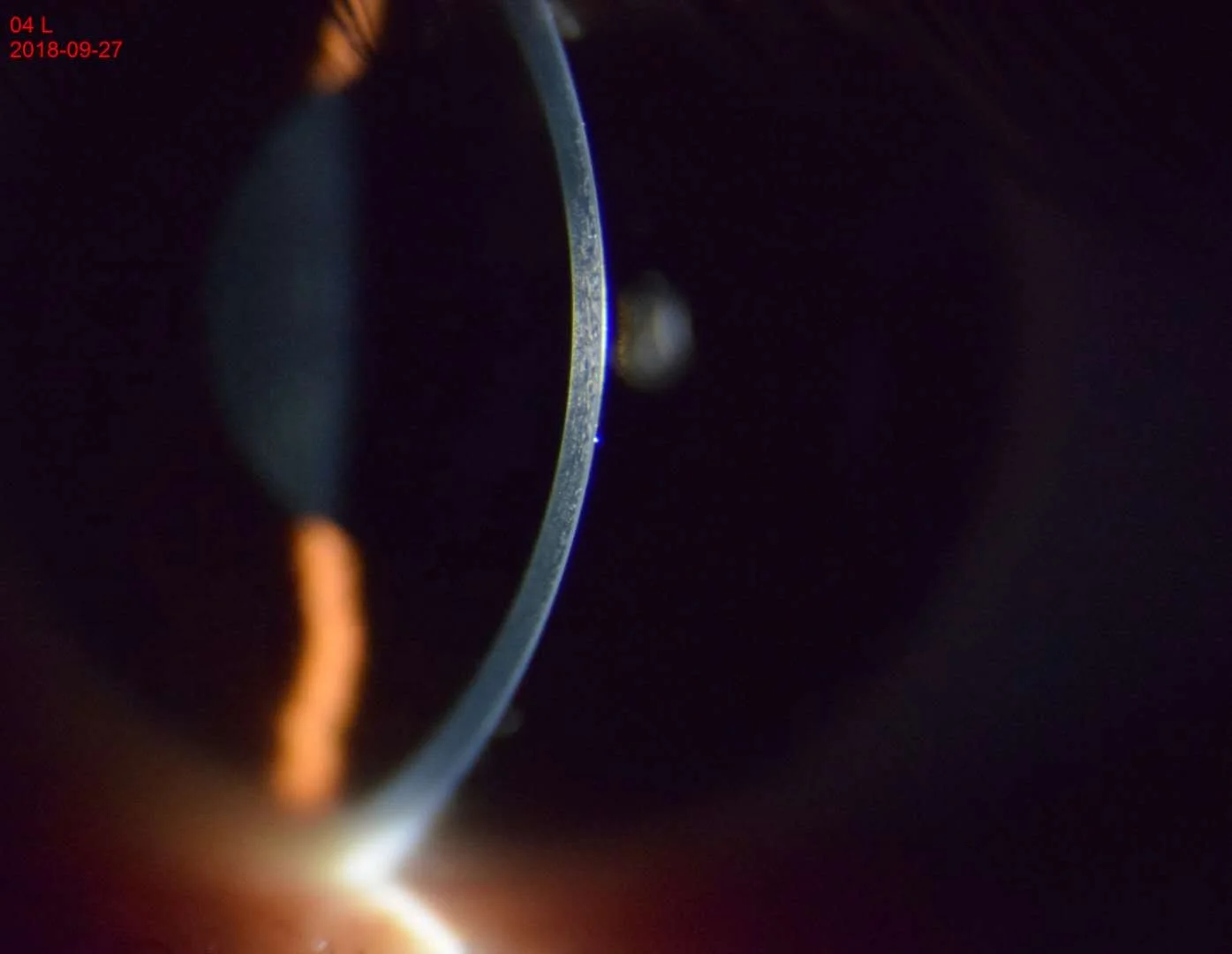 ML-3ER Most Advanced  Digital Slit lamp Tower type with very good feedback can equipped with tonometer