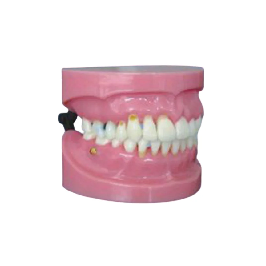 BIX-L1022 Comprehensive dental clinical symptoms teaching model periodontal disease demonstration model