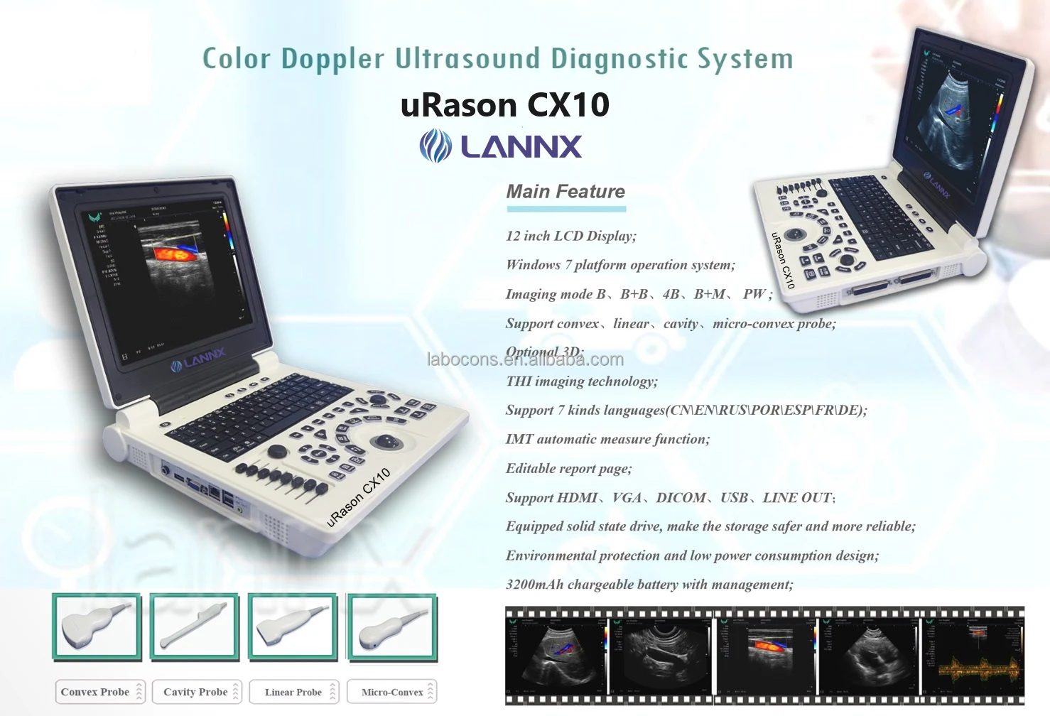 LANNX uRason CX10 Most popular ultrasonic Portable Hand Ultrasound Color Doppler Imaging Diagnostic Ultrasound Equipment