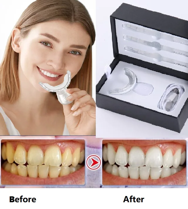 Другие аксессуары для отбеливания зубов набор беспроводного
