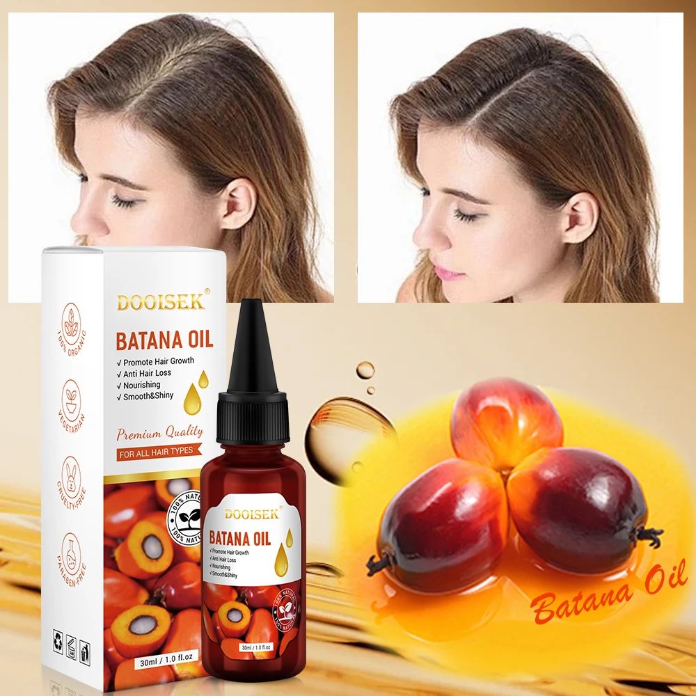 Factory Latest Hair Adivasi Batana Oil Alopecia Treatment Damaged Hair Regrowth Pousse Cheveux Hair Restoration Oil