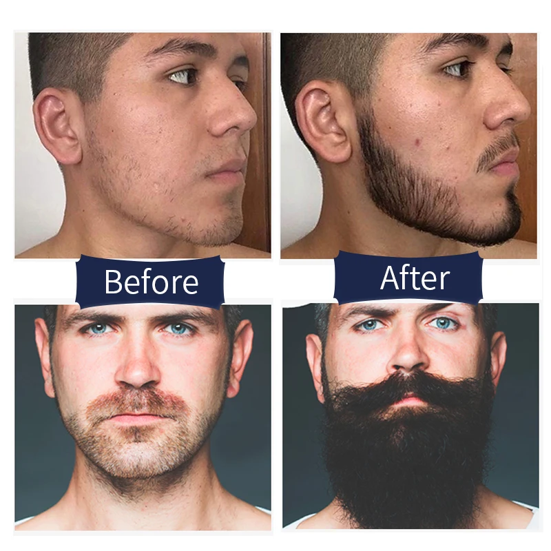 Собственная Марка 50 MOQ индивидуальный лучший уход за бородой мужское органическое масло жожоба Beardoil в комплекте способствует росту бороды масло