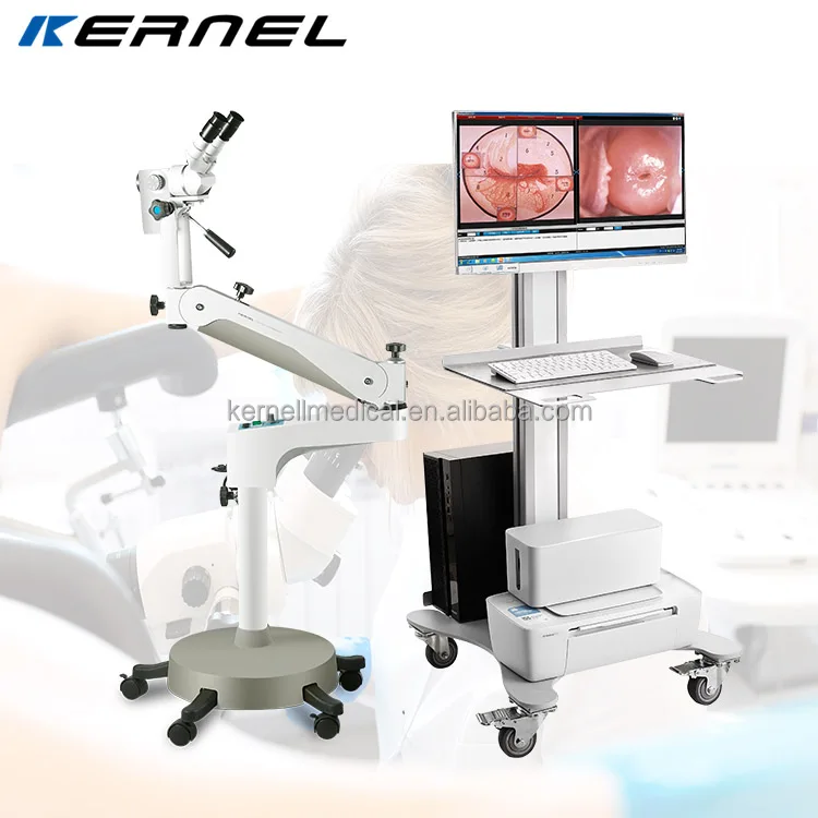 Medical EndoscopeVaginal Colposcopy Digital Imagin Portable Trolley Colposcope Gynecozlogy Optical Colposcope
