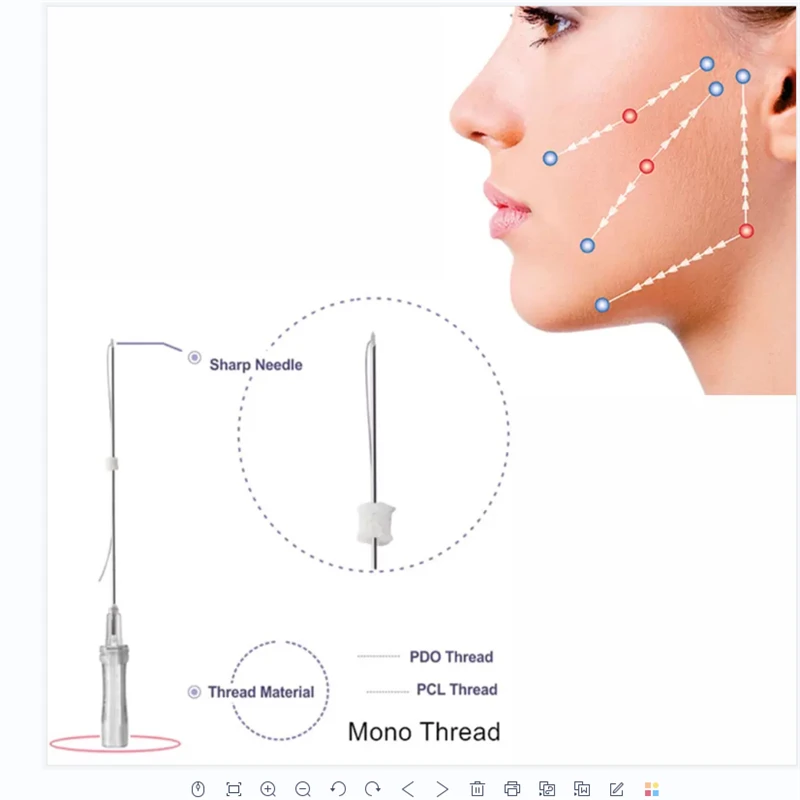 Hot sale face lift smooth 30g 25mm mono blunt canula 19g 100mm barbed 3d 4d 6d cog pdo thread