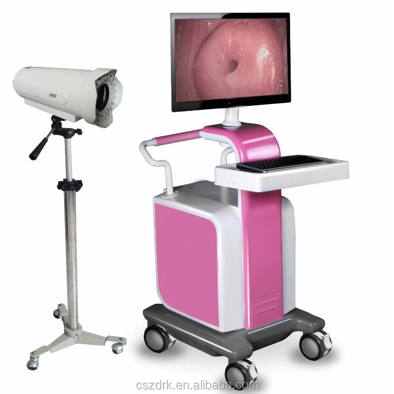 Clinical HD Camerea Gynecology Digital Video Colposcope