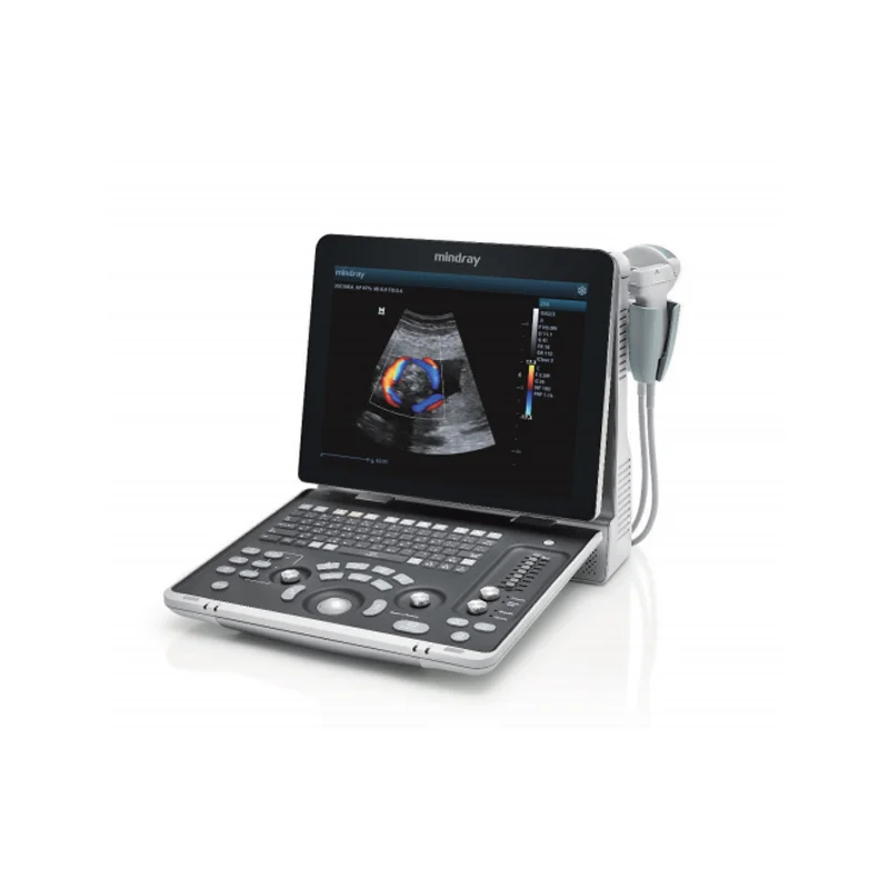 Mindray Z50BW цветной доплеровский ультразвуковой аппарат
