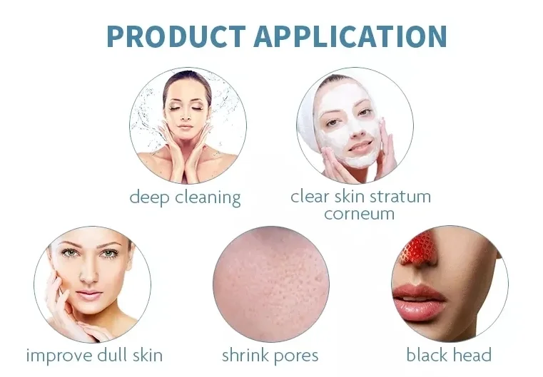 Hot product  blackhead removal skin clean  dermabrasion skin peel machine