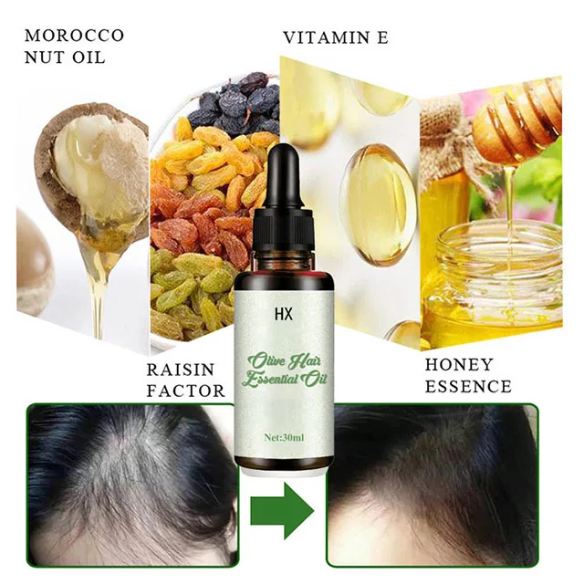 Growth Oil Private Label Serum Treatment Oils for Hair Spray Fast Organic Repair Grow Hair Loss Products