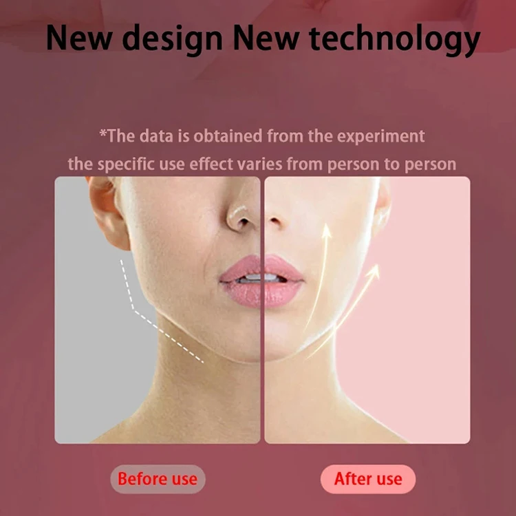 2024 New Hot Wholesale Neck Wrinkle Remover Device Double Chain Removal Machine Reducer Face And Neck Lifting Massager