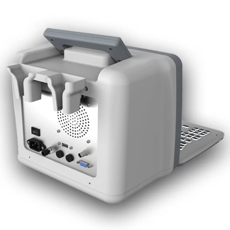 KBW-300 Laptop B&W Ultrasonic diagnostic portable B ultrasound scanner