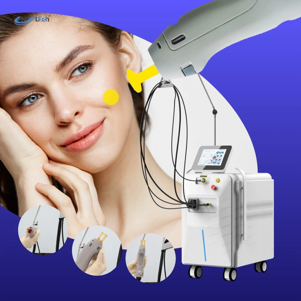 OEM ODM high quality hair removal candle ice 1064 755 alexandrite alex laser nd yag laser machine